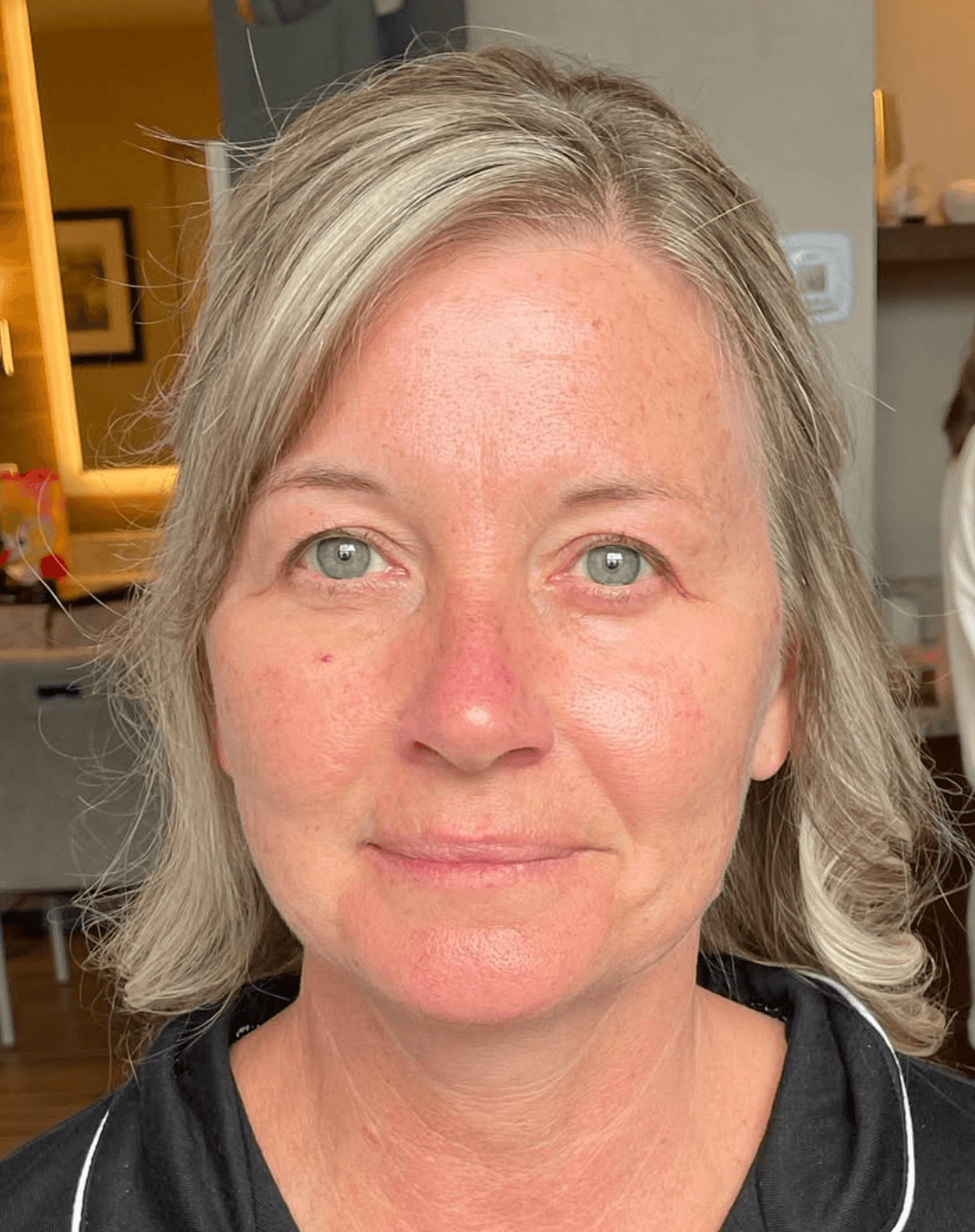 Before - Classic Elegance