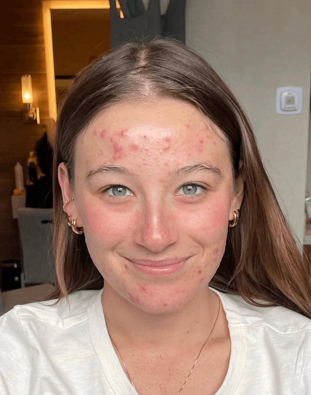 Before - Soft Bridal Glow