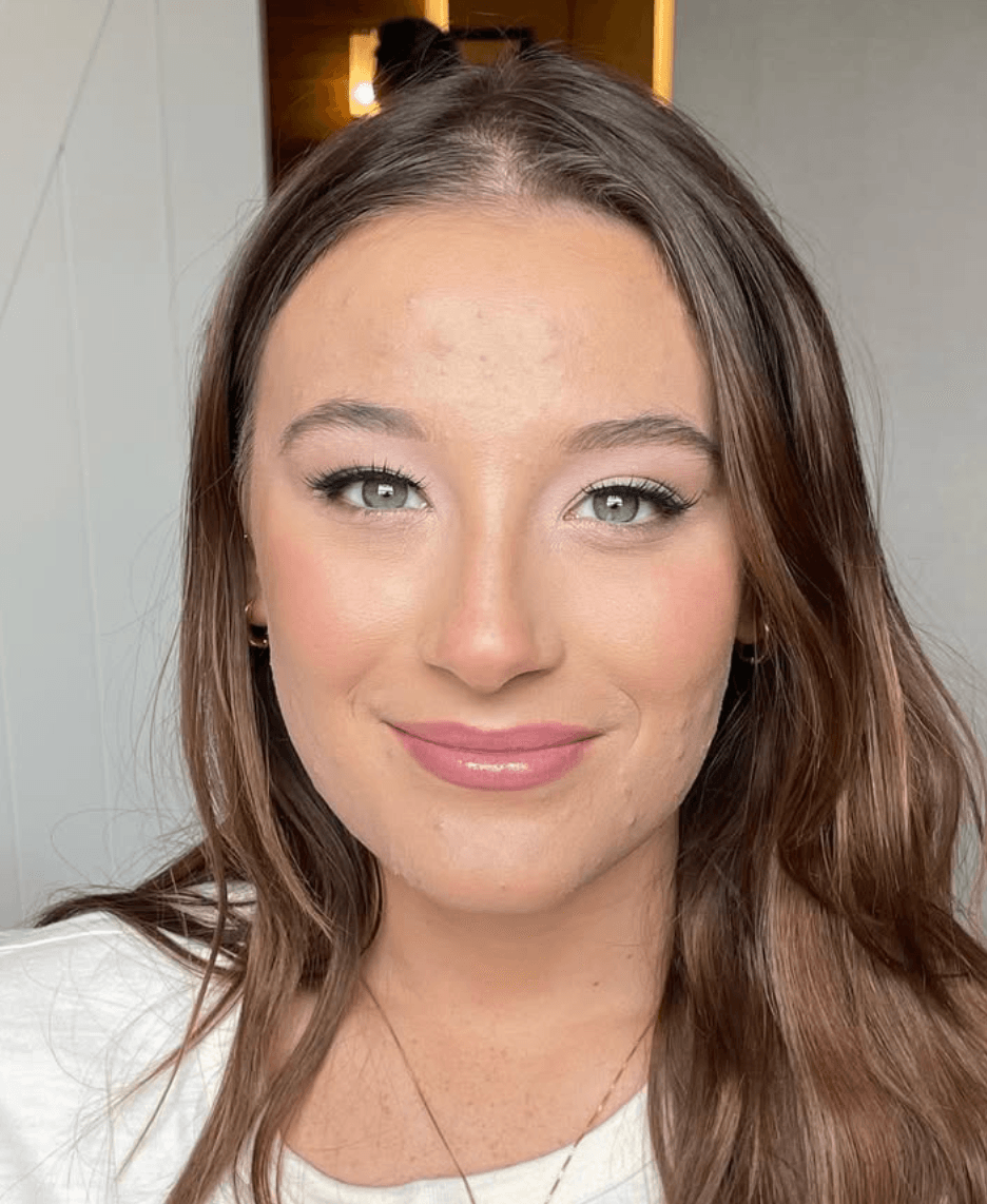 After - Elegant Beauty